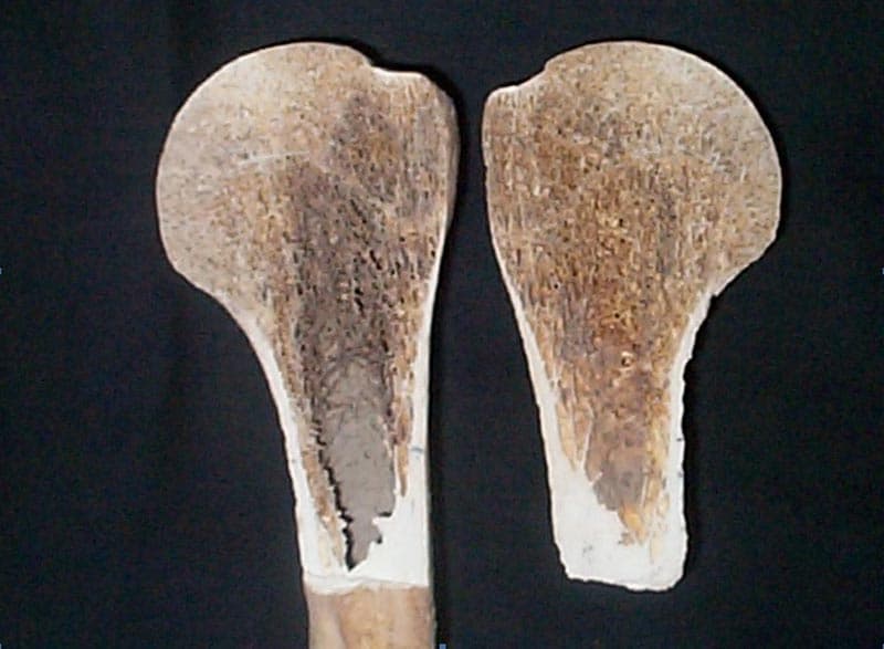 cheletul 2. Elemente pentru determinarea vârstei, humerusul stâng, faza II