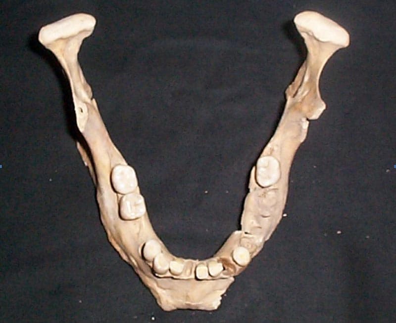 Scheletul 2. Elemente pentru determinarea vârstei - Mandibulă cu dentiţie foarte puţin uzată