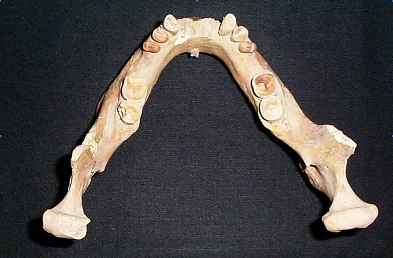 Scheletul 1. Elemente pentru determinarea vârstei: mandibulă, suprafeţele ocluzale ale dinţilor puternic uzate